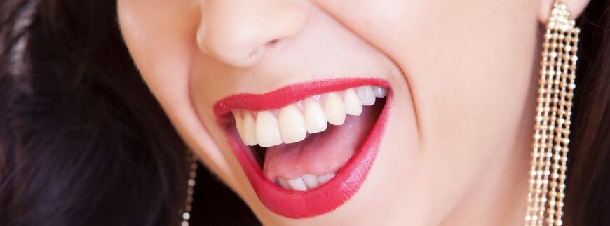 Miért jó a fogászati implantáció?